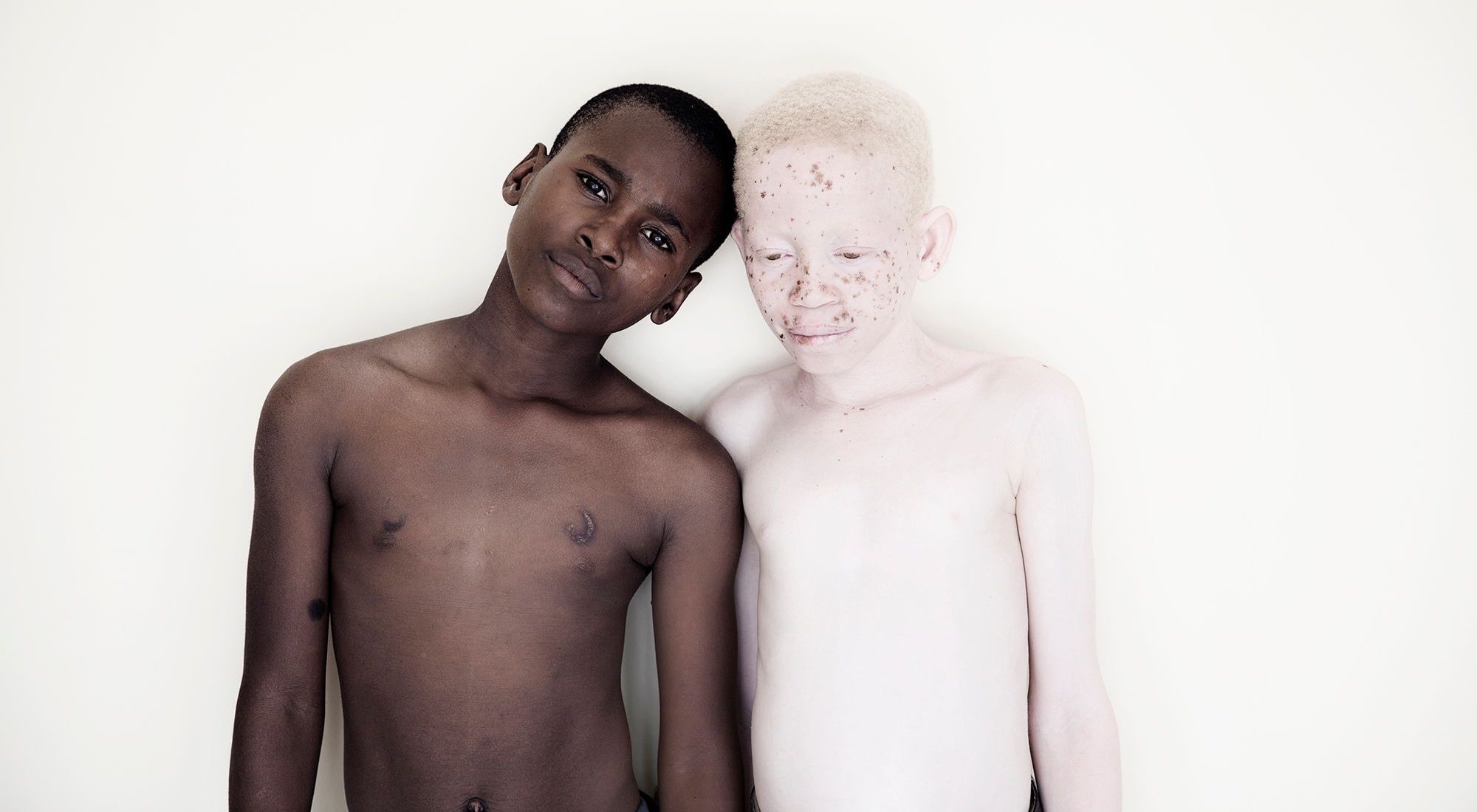 Под едно и също слънце ~ Белите деца на Танзания