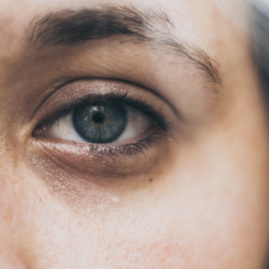 Синдром на сухото око - причини и лечение